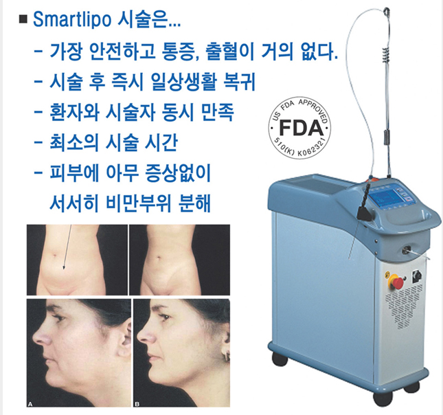 스마트리포