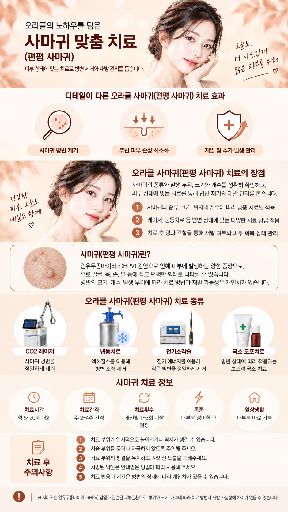 사마귀 치료 안내